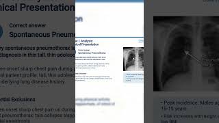 Teen With Sudden Chest Pain & Breathing Difficulty | Can You Diagnose It? 🫁