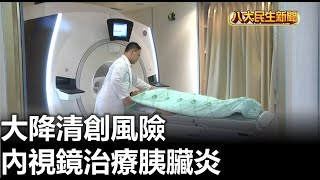 內視鏡治療胰臟炎 大降清創風險 |【民生八方事】| 2023022209 @gtvnews27