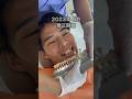 マウスピース矯正で人生変わった男の物語。#shorts #矯正日記 #マウスピース矯正