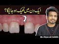 Fix your gap between teeth          inqalabfareed