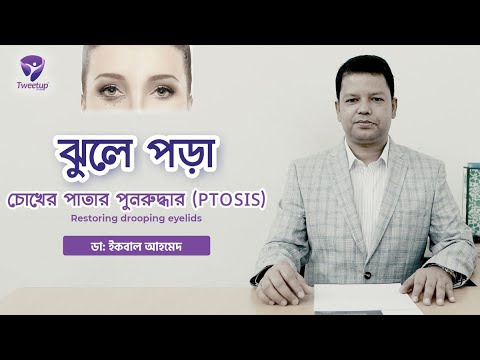 ঝুলে পড়া চোখের পাতার পুনরুদ্ধার (PTOSIS)-Restoring drooping eyelids [4K]