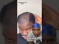 Man Goes Bald FROM THE #360wave WASH N STYLE METHOD!!?? #shorts #reaction