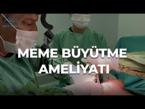 Meme Büyütme Ameliyatı | Göğüs Büyütme Operasyonu | Prof. Dr. Bekir Atik