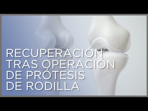 Vídeo: Cuidar A Alguien Después De Una Cirugía De Reemplazo De Rodilla: Consejos De Recuperación