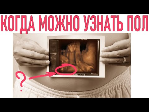 Видео: В каком триместре можно определить пол?