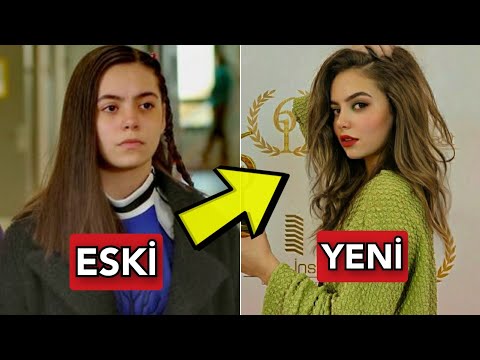 Tozkoparan İskender Dizisi Oyuncularının Şok Olacağınız Son Halleri!