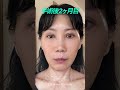 ビフォーアフターでわかる!たるみ改善