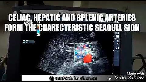 ULTRASOUND GUIDED CELIAC PLEXUS BLOCK : ANTERIOR APPROACH