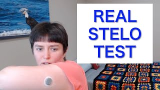 Dexcom Stelo Review: Setup, Demo & First Impressions (Over-the-Counter CGM)