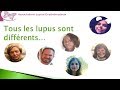 Le lupus et lassociation lupus rythmateux