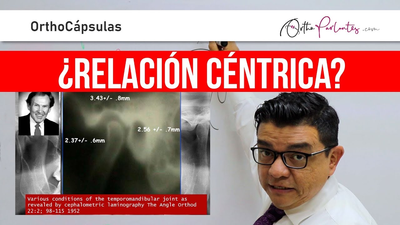 Relación Céntrica con el Dr. Carlos Martínez - OrthoCápsula #001
