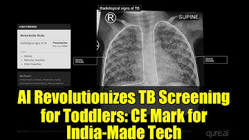 AI Revolutionizes TB Screening for Toddlers: CE Mark for India-Made Tech