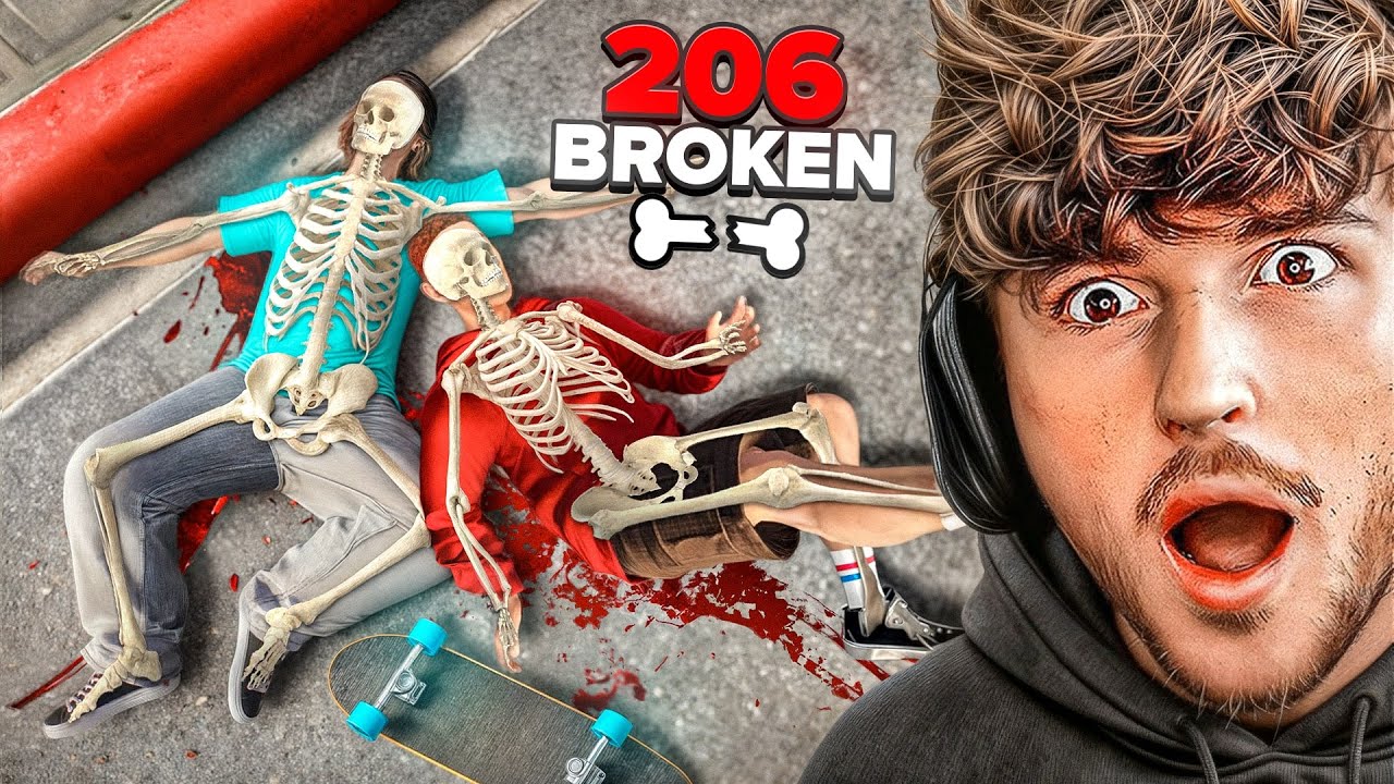 Мы сломали ВСЕ 206 КОСТЕЙ, катаясь на коньках..