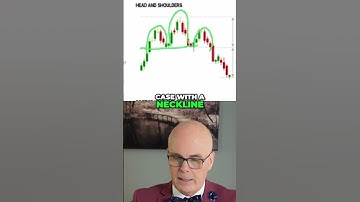 Mastering Head and Shoulders  Essential Trading Patterns #trading #stocks #financialanalysis