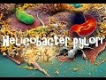 Helicobacter pylori