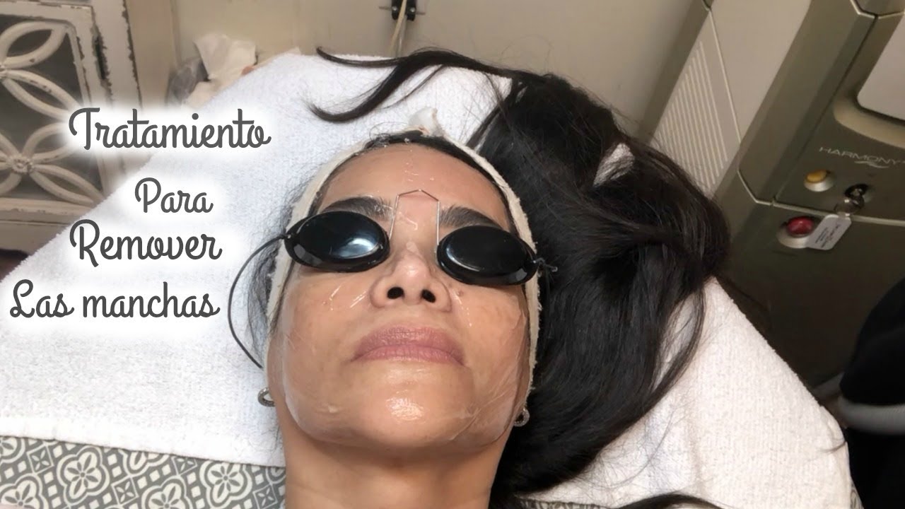 Eliminar Manchas en la Cara con Láser: Precio en Valencia y Resultados