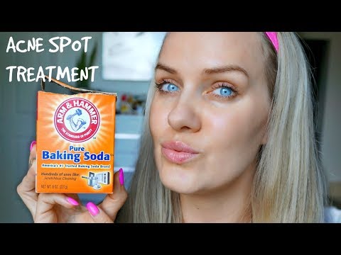 HOW TO GET RID OF ACNE USING BAKING SODA - SPOT TREATMENT IN 5 DAYS