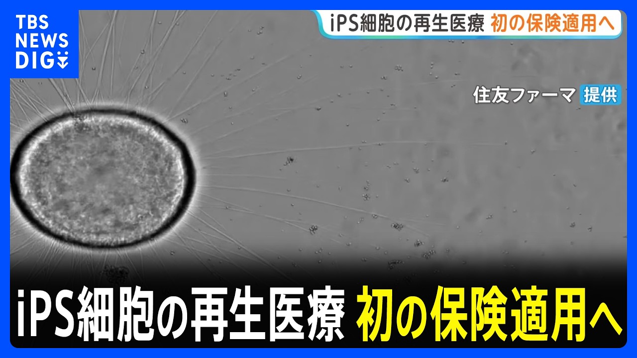 Breaking News] 