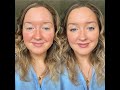 No make-up make-up look using Bye Bye Under Eye Concealer