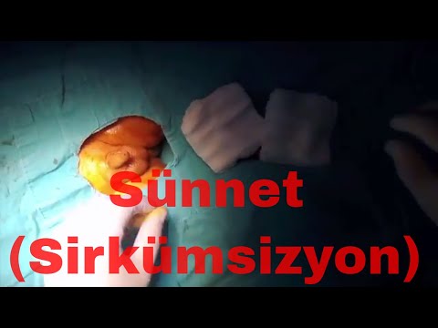 Sünnet Nasıl Yapılır Ameliyat Videosu izle