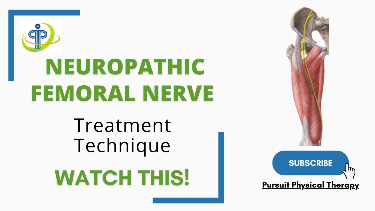 Neuropathic Femoral Nerve Treatment Technique YouTube