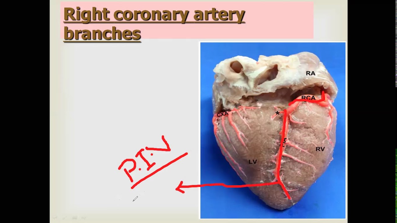 Anatomy-Blood supply of the heart - YouTube