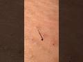 ♩ #plucking #satisfying #tweezers #blackheads #pimple #skincare #hair #hairremoval #extraction #埋没毛