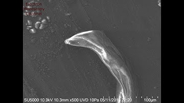 C elegans under the Electron Microscope