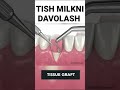 Milk Implantantsiyasi 3D Animatsiyasi 