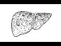 What is Fatty Liver Disease?