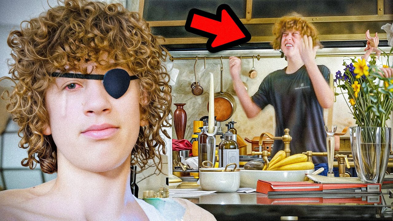 NELSON LOST HIS EYE 😳