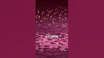 How Gold Nanoparticles Can Kill Tumor Cells 