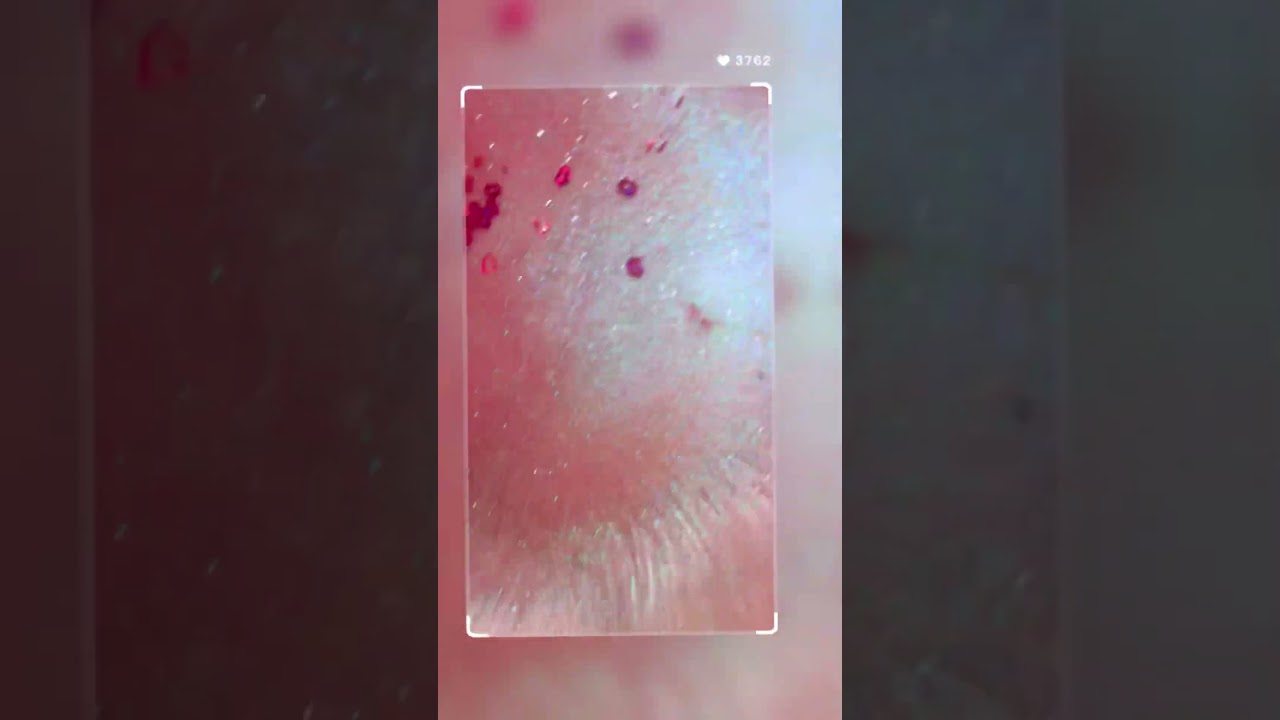 Color explosion of Epoxy! 2025 