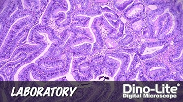 Dino-Lite Applications: Laboratory