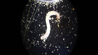 Larvae from pond scum under compound microscope