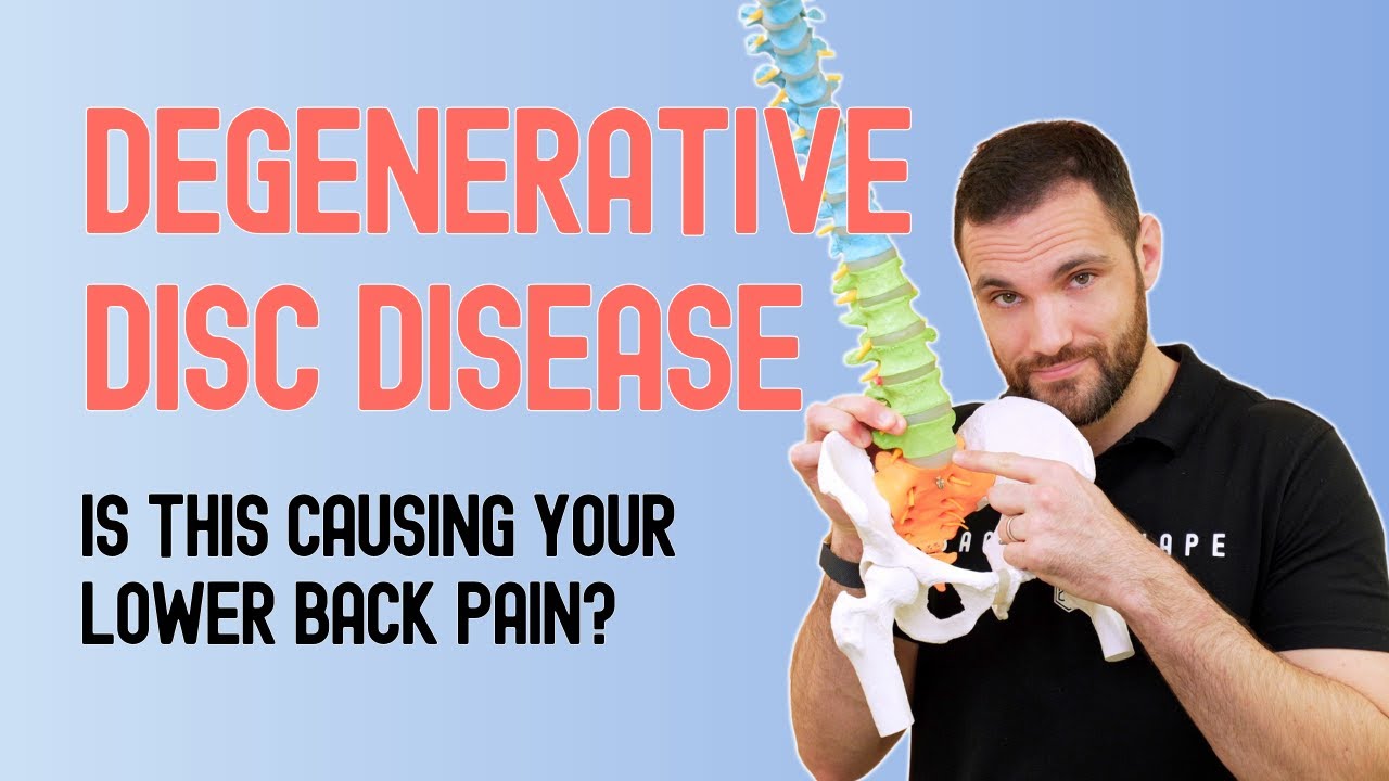 Why Is Degenerative Disc Disease Causing Low Back Pain? - YouTube