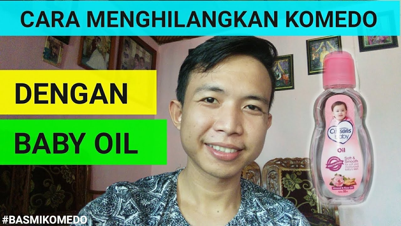 Cara Menghilangkan Komedo Dengan Menggunakan Baby Oil By Aji Uly Youtube Cara Menghilangkan Komedo Dengan Menggunakan Baby Oil By Aji Uly Youtube
