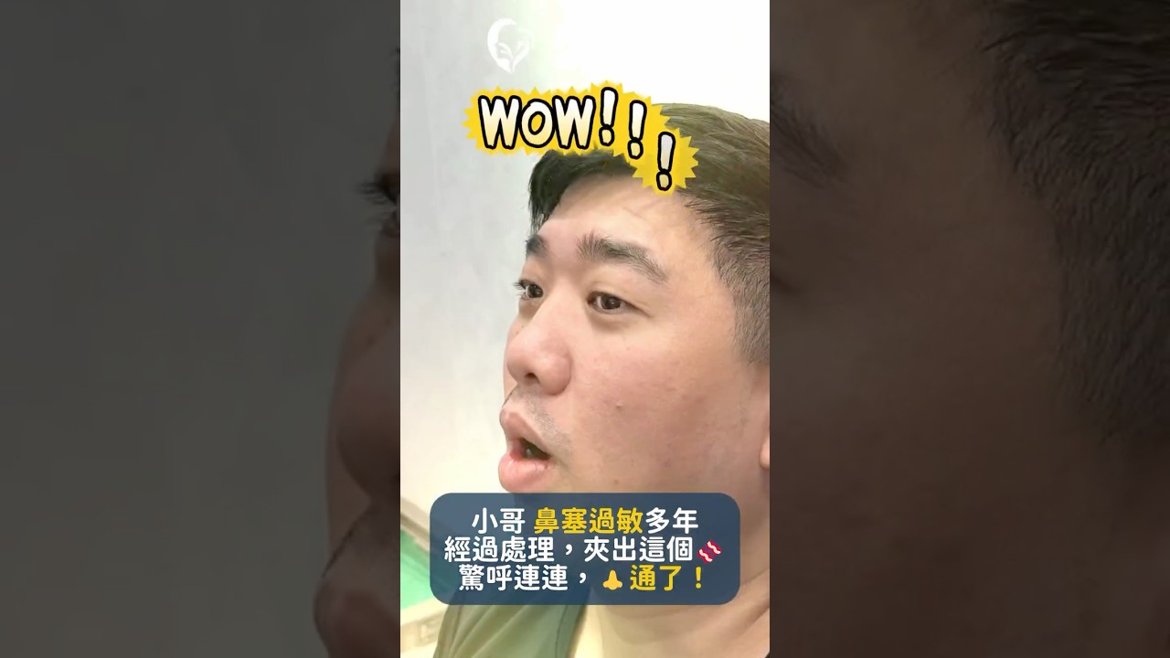 鼻塞過敏可以透過手術治療。 #鼻塞 #鼻過敏 #微創手術 #弘育耳鼻喉科診所 #弘育耳鼻喉科診所 縮圖