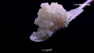 maxgraft® Granules: Versatile Allograft Solution for Bone Regeneration in Implant Dentistry