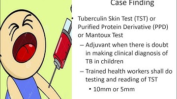 Epidemiology of Tuberculosis