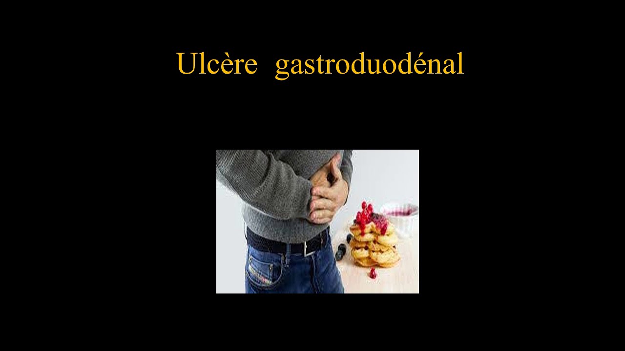 Ulcère gastroduodénal, comment le guérir rapidement ? - YouTube
