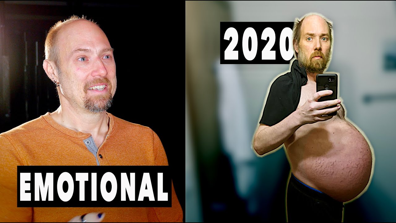 HE NEARLY DRANK HIMSELF TO DEATH... His Liver Was Failing  | Survivors Testimony EP. 2