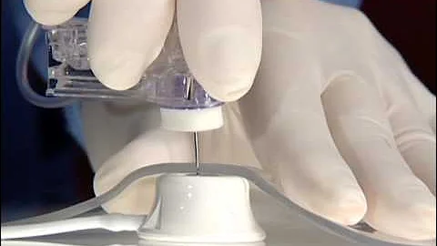 Smiths Medical Gripper Micro