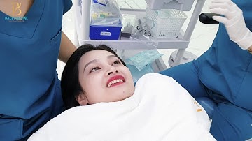 BÁC SĨ ĐỖ MẠNH TOÀN  THỰC HIỆN  DÁN SỨ EMAX EXTRA THIN CHO " EM GÁI HOT GIRL CHI PU".