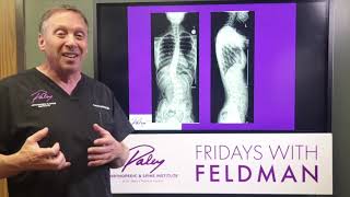 Scoliosis Non-Fusion Surgical Treatment / David S. Feldman, MD