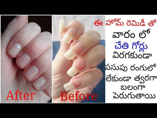5 Home Remedies To Grow Longer & Stronger Finger Nails