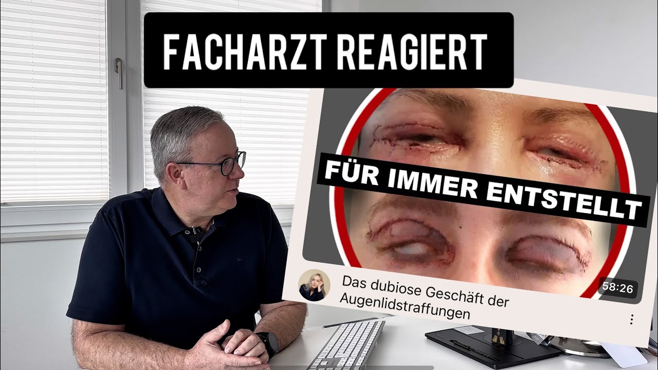 Das dubiose Geschäft der Augenlidstraffung - Plastischer Chirurg reagiert 