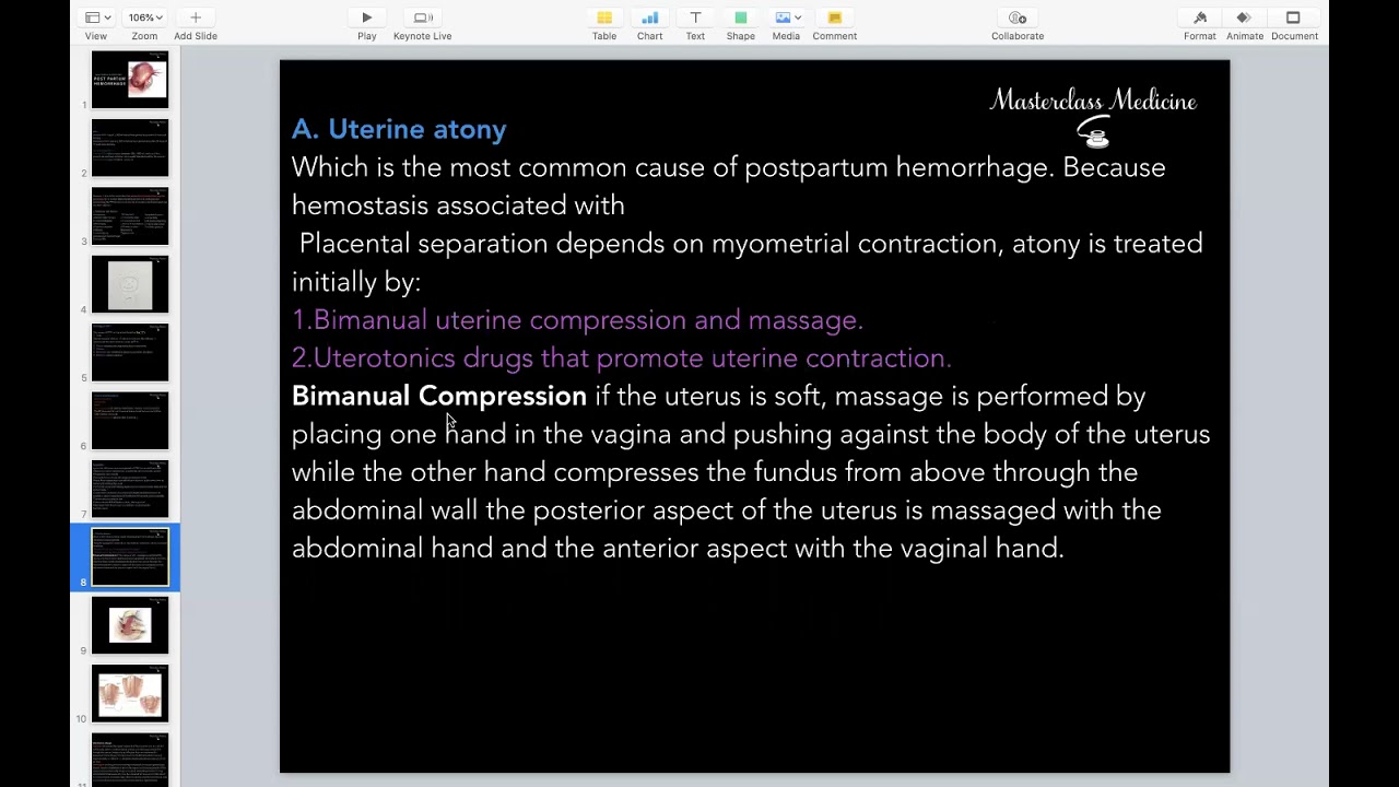 Post Partum Hemorrhage (PPH) - OB course - Masterclass Medicine