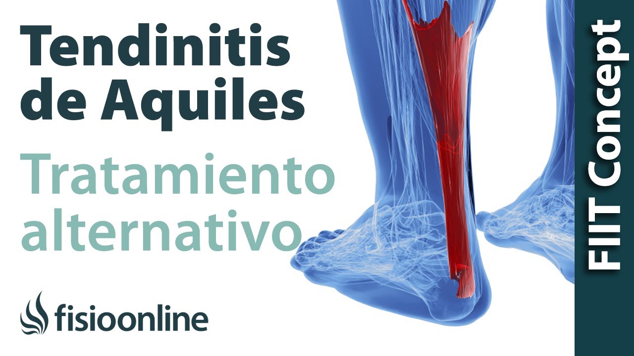 dolor punzante en el talon de aquiles