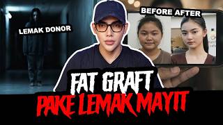 SUNTIK LEMAK MAYIT FAT GRAFT - TC